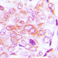 Anti-BMP5 Antibody