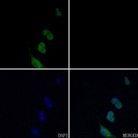 Anti-BMP5 Antibody