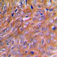 BNIP2 Antibody