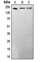 BRCA1 Rabbit Polyclonal Antibody