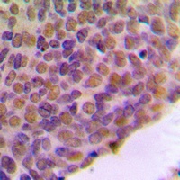 BRCA1 Rabbit Polyclonal Antibody