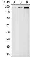 BRCA1 Rabbit Polyclonal Antibody