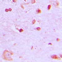 BRCA1 Rabbit Polyclonal Antibody