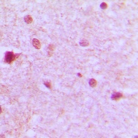 Anti-ZFP36L1 Antibody