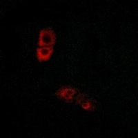 Anti-BRS3 Antibody