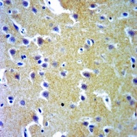 Anti-Probetacellulin Antibody