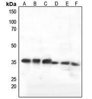C1QBP Antibody [KO/KD Validated]