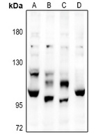 Complement C6 Antibody