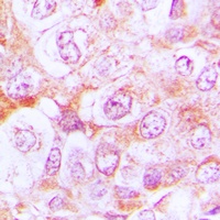 Complement C6 Antibody