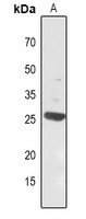 Carbonic Anhydrase 1 Antibody