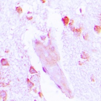 Carbonic Anhydrase 1 Antibody