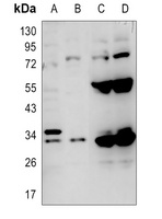 Carbonic Anhydrase 5A Rabbit Polyclonal Antibody