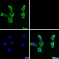 Anti-Carbonic Anhydrase 5A Antibody