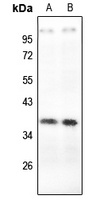 Carbonic Anhydrase 6 Rabbit Polyclonal Antibody