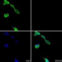 Anti-Carbonic Anhydrase 9 Antibody