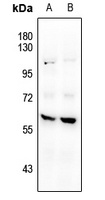 CaMK2 beta Rabbit Polyclonal Antibody