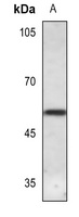 CaMK2 delta Rabbit Polyclonal Antibody