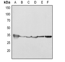 Cleaved Caspase 2 Rabbit Polyclonal Antibody