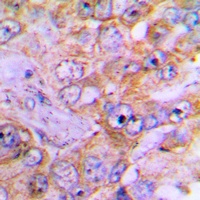 Caspase 3 Antibody [KO/KD Validated]