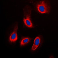 Caspase 3 Antibody [KO/KD Validated]