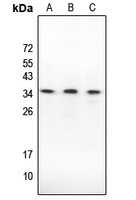 Caspase 3 Antibody [KO/KD Validated]