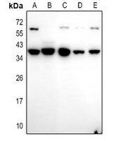 Caspase 3 Antibody