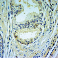Caspase 3 Antibody