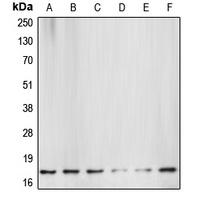 active Caspase 3 Rabbit Polyclonal Antibody