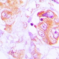 active Caspase 3 Rabbit Polyclonal Antibody