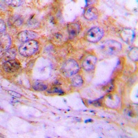 Anti-Caspase 4 Antibody