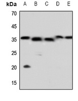Caspase 5 p10 Rabbit Polyclonal Antibody