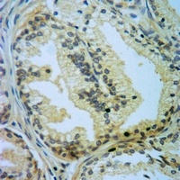 Anti-Caspase 5 p10 Antibody