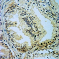 CASP5 antibody