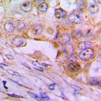 Caspase 6 p18 Antibody