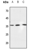 Caspase 6 Rabbit Polyclonal Antibody
