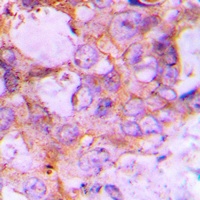 Caspase 6 Rabbit Polyclonal Antibody