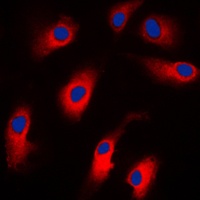 Anti-Caspase 7 Antibody