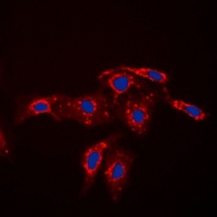 Anti-Caspase 7 p11 Antibody