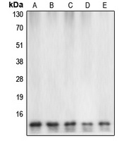 Caspase 7 Rabbit Polyclonal Antibody