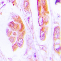 Caspase 7 Rabbit Polyclonal Antibody