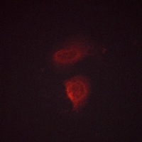Calcium Sensing R (phospho-T888) antibody