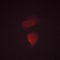 Anti-Calcium Sensing Receptor (Phospho-T888) Antibody