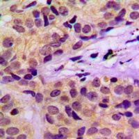 c-CBL (Phospho-Y674) Antibody