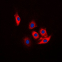 c-CBL (phospho-Y774) antibody