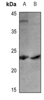 Cerebellin 1 Antibody