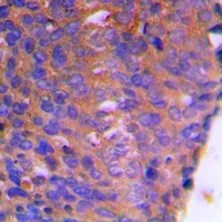 Anti-CBR1 Antibody