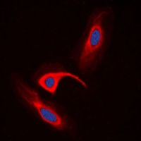 Prostaglandin-E(2) 9-reductase antibody