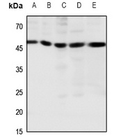 CCKBR Rabbit Polyclonal Antibody