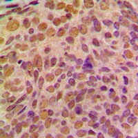 Anti-Cyclin B1 Antibody