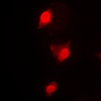 CCNB1 antibody